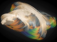 A quaternionic Julia set -tridimensional cross-section- 