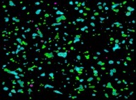 Visualization of the areas where the density is greater than 0.62 during a tridimensional diffusion process of 128312 particles 